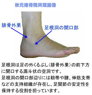 腫れ くるぶし 足首やくるぶし・膝など滑液包炎の起こる部位や原因と治療法