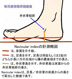 Navicular_index̌v