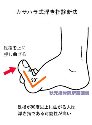 浮き指 症状 原因 改善法