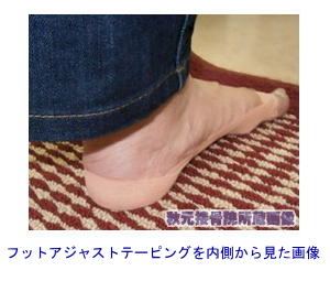 tbgAWXge[sO猩摜
