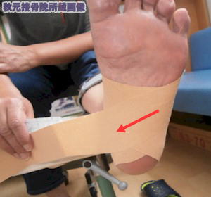 足の甲 リスフラン関節のテーピング
