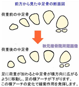 前方から見た中足骨の断面図