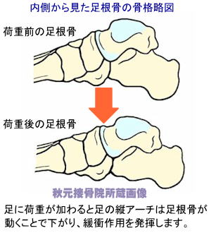 内側から見た足根骨の骨格略図