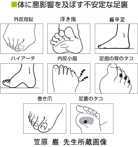 小指 違和感 の 足